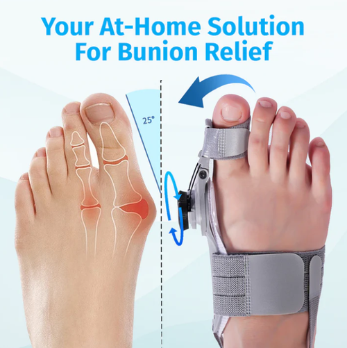 2026🔥Tiqure™ Bunion Fix